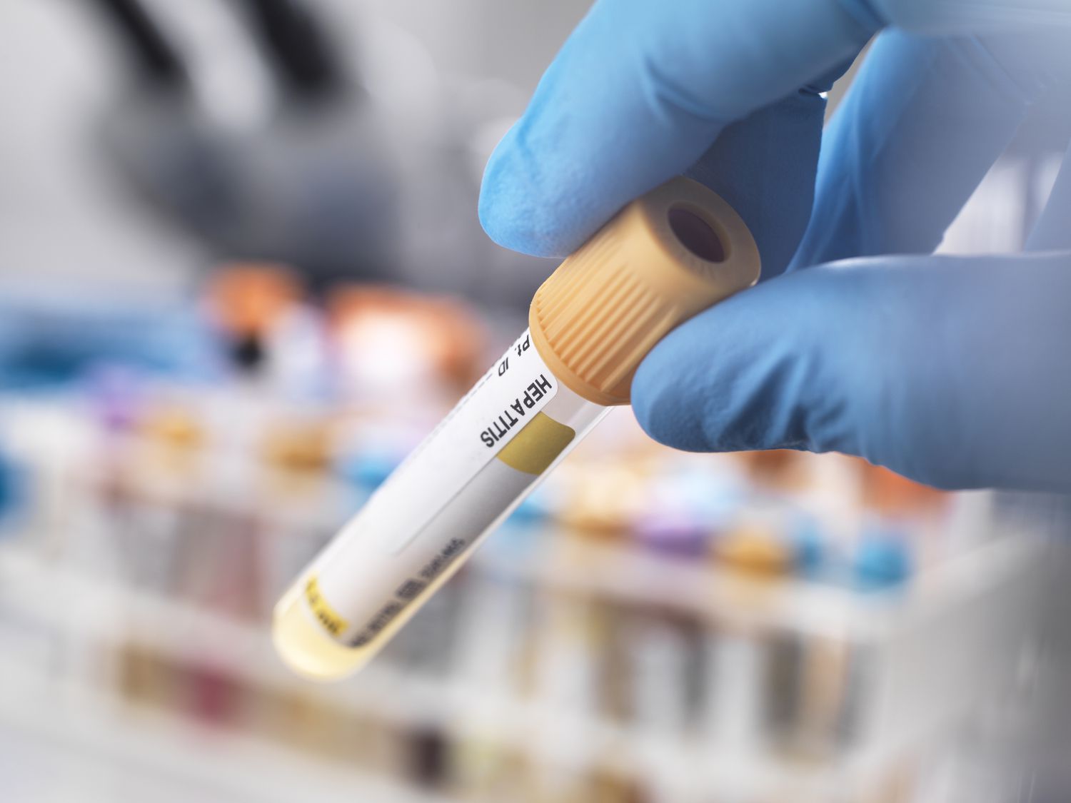 std test dubai